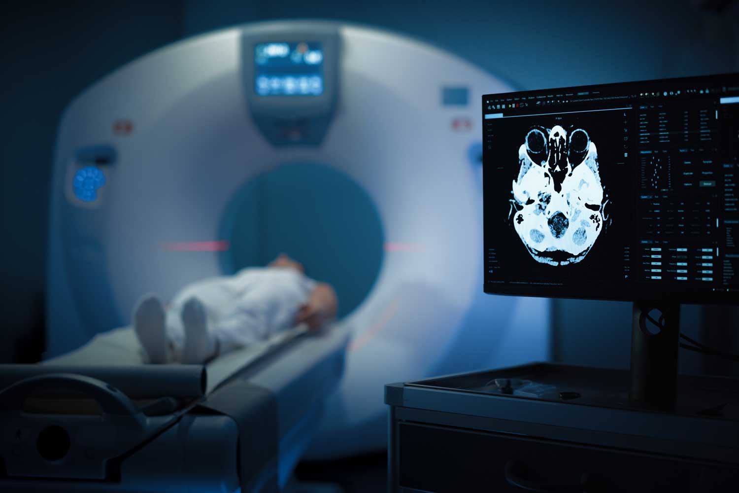 SIEMENS 64 Slice CT Scan